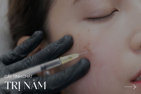 Cấy tinh chất trị nám